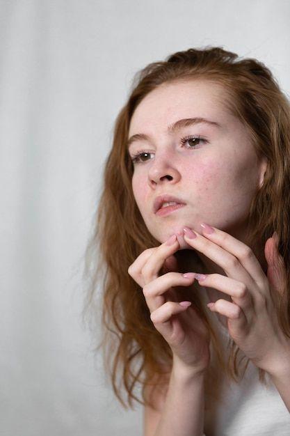 A young teenage girl squeezes out pimples on her face by looking in the mirror _ Premium Photo (1)